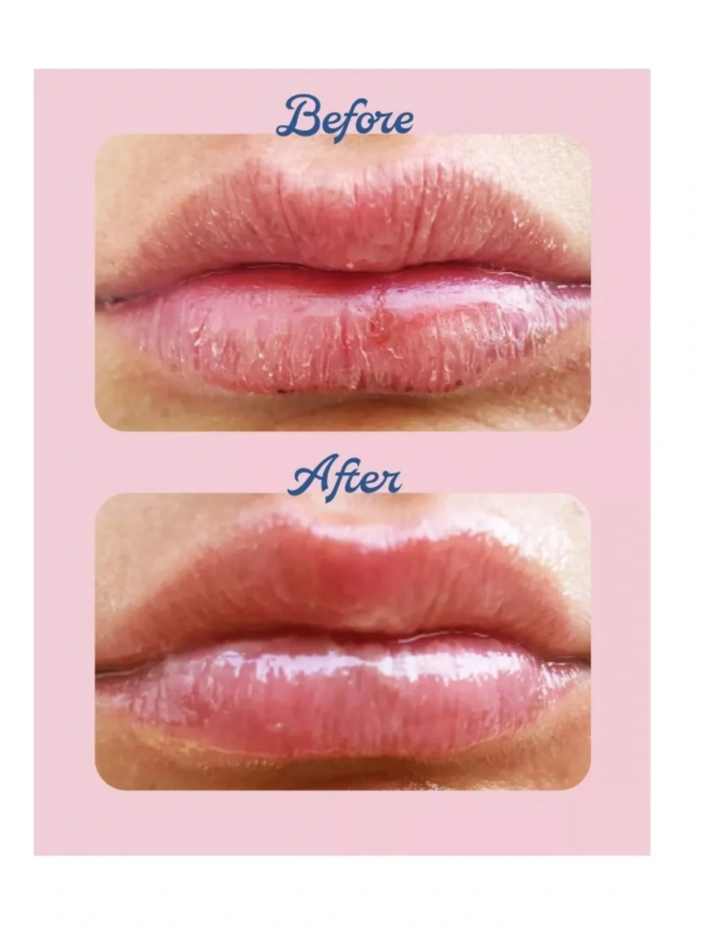 Lanolips Strawberry 101 Ointment Multi-Balm Lip Treatment NIB Vitamin E